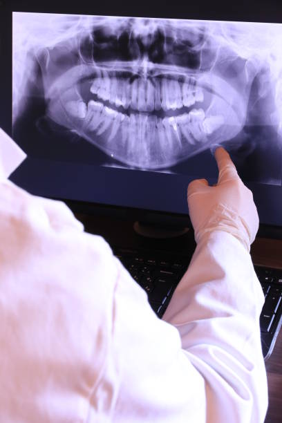 Best Dental Abscess Treatment in Jupiter Farms, FL